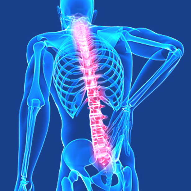 Scoliosis – The Harmonic Confluence Healing Arts Centre